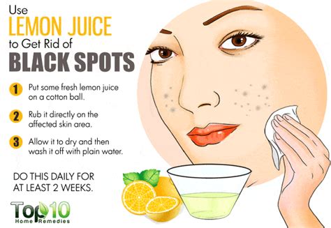 How do you get rid of fordyce spots? 10 Home Remedies to Get Rid of Dark Spots on Face | Top 10 ...