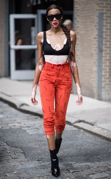 Winnie Harlow From Best Celeb Street Style From New York Fashion Week
