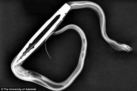 Winston The Python Undergoes Surgery After Swallowing Metal Bbq Tongs