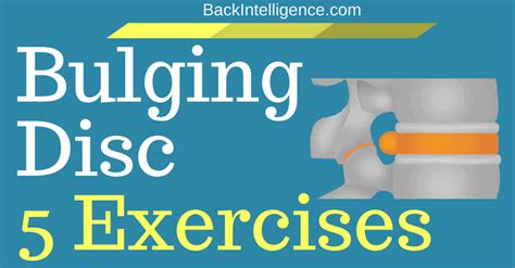 The affected disc only becomes a problem when it protrudes enough. Bulging Disc Treatment In Lower Back - 5 Exercises You Can ...