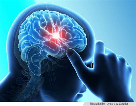 Comparison with the national institutes of health stroke scale and prediction of middle cerebral artery occlusion. IBM's Watson Comes To Aid : To Help Tackle Brain Tumour ...