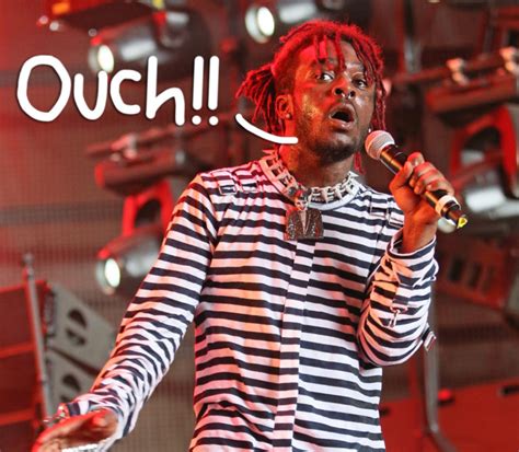 lil uzi vert reveals that 24 million diamond he implanted in his forehead got ripped out by
