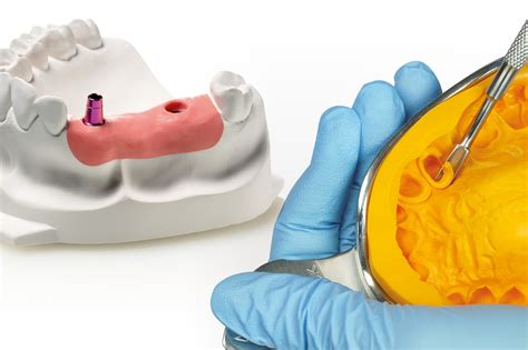 Materiales Para Impresiones Dentales Elásticos Y Rígidos La Clasificación