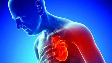 Cardiac arrest is the sudden loss of cardiac function, when the heart abruptly stops beating. Cardiac Arrest Survival Rates Higher with CPR and AED Use ...