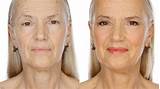 Pictures of Makeup Older Skin