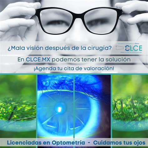 Cirugía refractiva Mala visión después del procedimiento Clínica de Lentes de Contacto