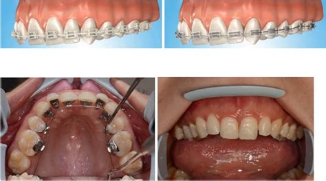 Orthodontics And Orthopedics Implantodent