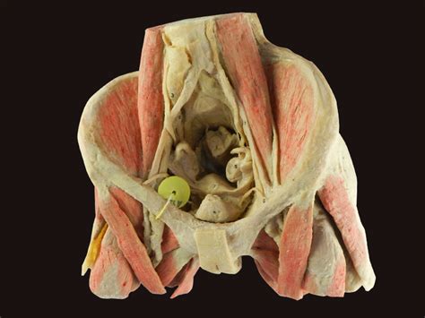 Female anatomy includes the external genitals, or the vulva, and the internal reproductive organs. Female pelvic organs human body plastination,male pelvis medical teaching model, medical specimens