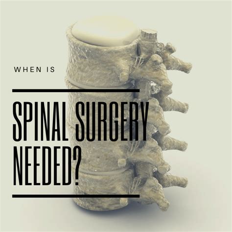 When Spine Surgery Is Needed New Jersey Comprehensive Spine Care