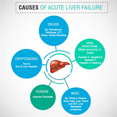Acute Liver Failure Treatments Symptoms And Causes