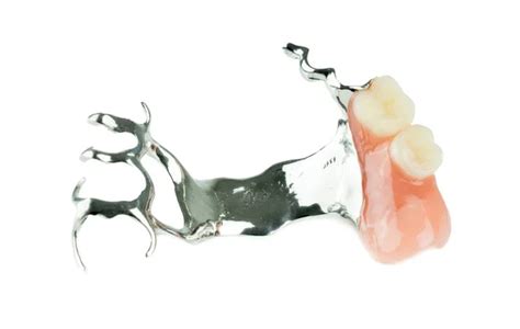 Removable Partial Denture Stock Photos Royalty Free Removable Partial