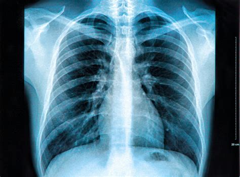 The Science Behind X Ray Imaging