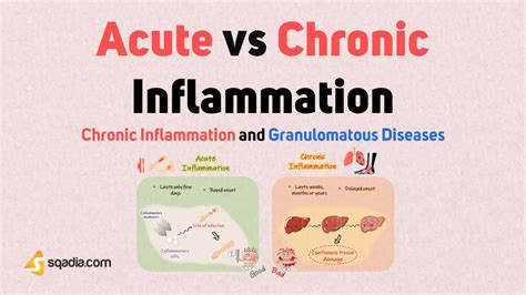 Chronic Inflammation And Granulomatous Diseases Acute Vs Chronic