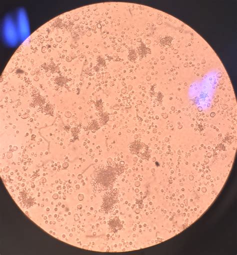 Cell Culture Contamination Pics Labrats