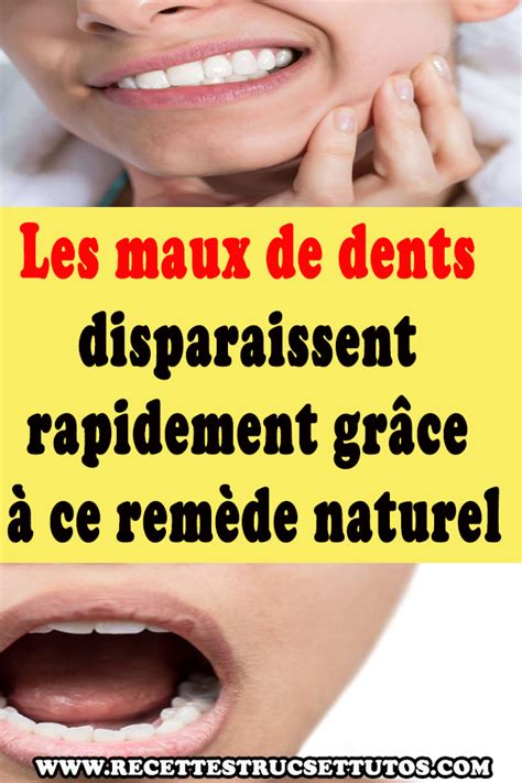 Mal De Dents Rem Des Pour Calmer Les Douleurs Dentaires My Xxx Hot Girl