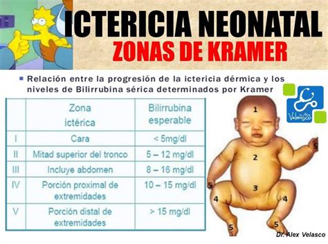 Zonas De Kramer Icterícia Braincp