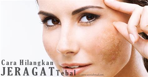 Cara menghilangkan bruntusan di wajah memang bisa berbagai macam. Cara Hilangkan Jeragat Tebal di Muka - azeniahmad.com