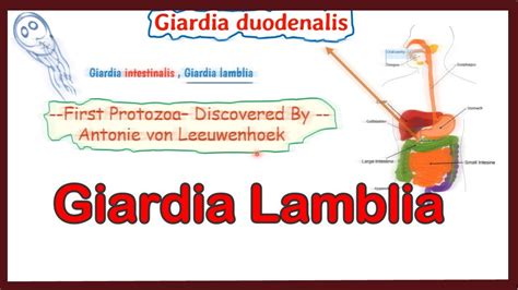 paraziták giardia lamblia)