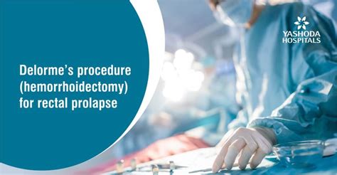 delorme s procedure hemorrhoidectomy for rectal prolapse yashoda hospitals