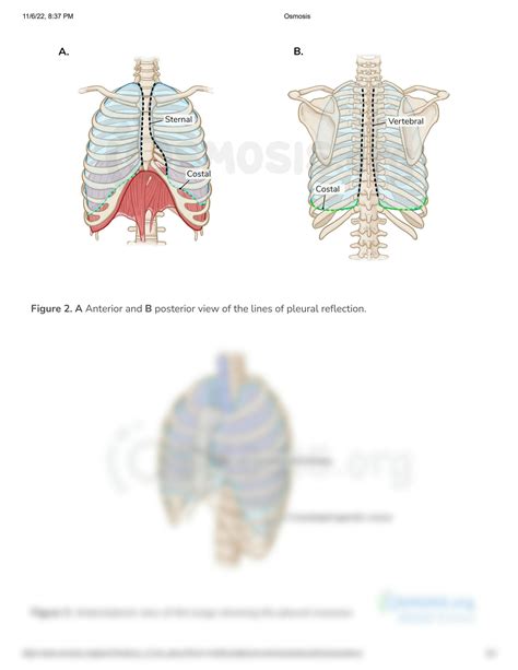 Anatomy Of The Pleura Video Anatomy Definition Osmosis My Xxx Hot Girl