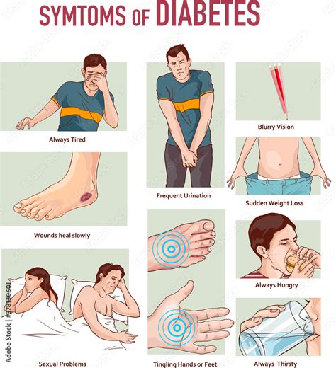 Vector Illustration Of A Symptoms Of Diabetes Infographic Diagram Vector De Stock Adobe Stock