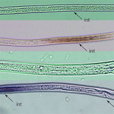 Tissue Localization Of Aphelenchoides Besseyi Cathepsin B Gene Ab Cb 1