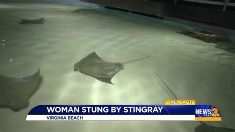 Virginia Beach Woman Shares Story After Being Stung By Stingray