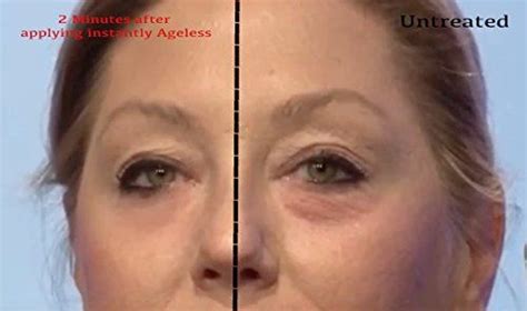 Instantly Agelesstm By Jeunesse 1 Box Comes With 25 Vials Anti Wrinkle