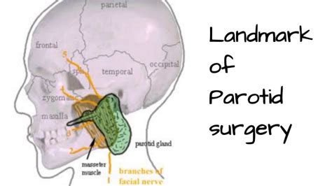 Landmarks Of Parotid Surgery Youtube