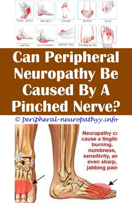 Troubleshoot/optimize your diet of choice. Pin on Peripheral Neuropathy Icd 10