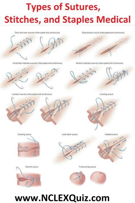 Types Of Sutures Stitches And Staples Medical Surgical Suture