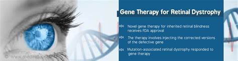 Fda Approval Of Gene Therapy For Inherited Form Of Blindness Marks A
