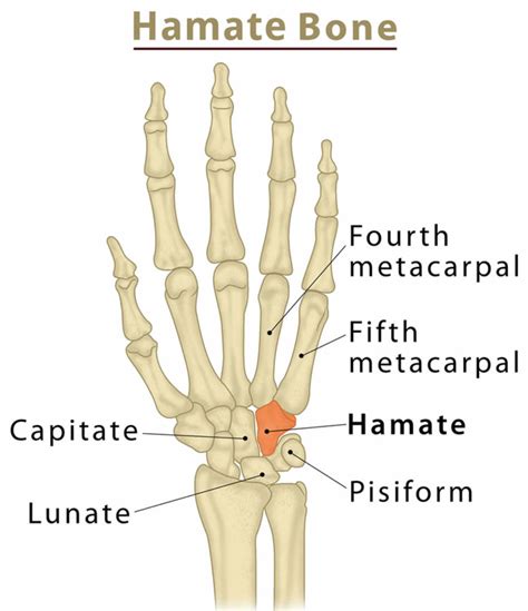 Hamate Fracture Causes Types Symptoms Diagnosis Treatment And Prognosis