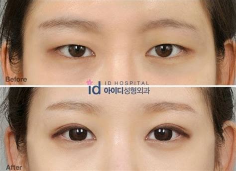 Korean actress with big eyes. Big Eye Korean Surgery | Foto Bugil Bokep 2017