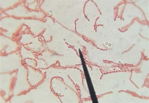 Endospores Under Microscope