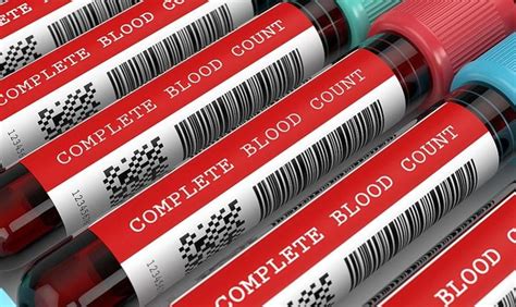 Kenapa sel darah putih tinggi. Pemeriksaan Darah Lengkap: Jenis, Indikasi, hingga Cara ...