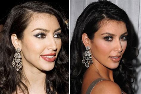Kim Kardashian Plastic Surgery Has Kim Had A Nose Job