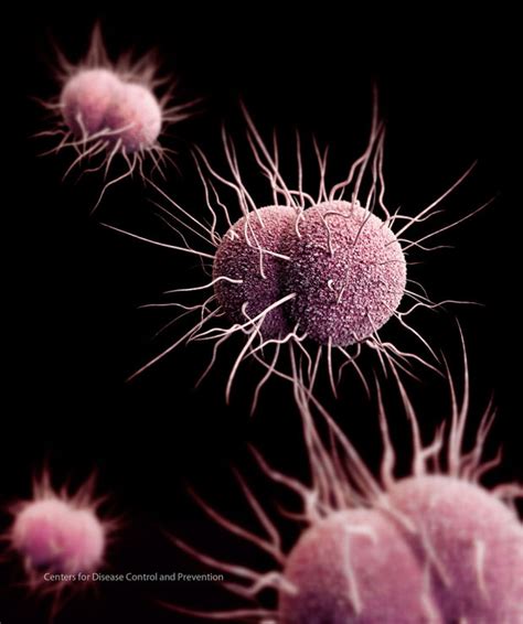 Untreatable Super Gonorrhoea Spreading Across Britain The Universal