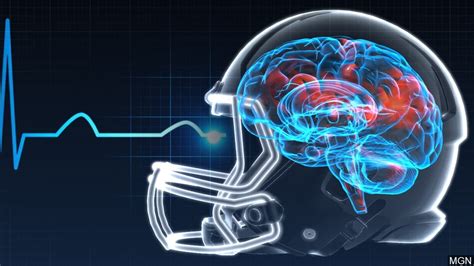 Concussion Screening And Tests Sadar Psychological And Sports Center