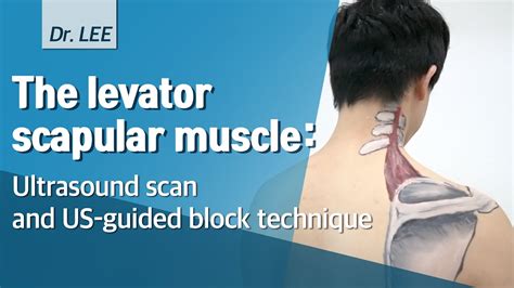 Tthe Levator Scapular Muscle Ultrasound Scan And Us Guided Block