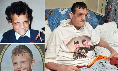 7ft And Still Growing Rare Condition Means Robert 24 Is A Prisoner