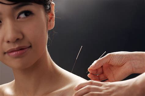 dry needling benefits balanced body acupuncture and chiropractic