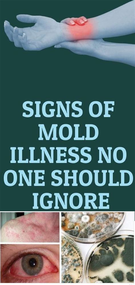 Signs Of Mold Illness No One Should Ignore Mold Exposure Natural