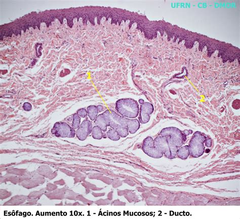 Tecido Epitelial Glandular Laminas Histologia E Embriologia Porn Sex