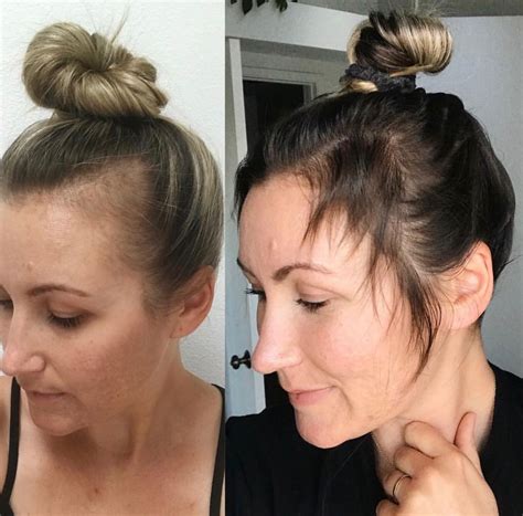 If you have experienced postpartum hair loss a few months after birth, you have probably seen bald patches. MONAT for post partum hairloss in 2020 | Monat hair, Monat ...