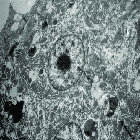 Transmission Electron Micrograph Of A Portion Of Hepatic Cells Showing