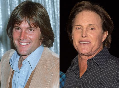 Bruce Jenner From Better Or Worse Celebs Who Have Had Plastic Surgery