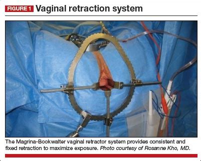 Transforming Vaginal Hysterectomy Solutions To The Most Daunting