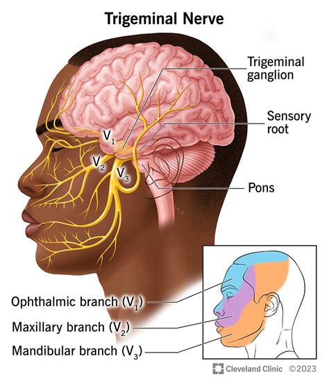 Foods That Trigger Trigeminal Neuralgia Hot Sex Picture