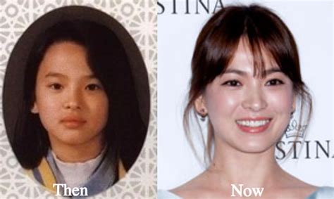 Nov 22, 1981 but registered on feb 26, 1982 (where do they get these information!) blood type: Song Hye Kyo Plastic Surgery Before and After Photos ...